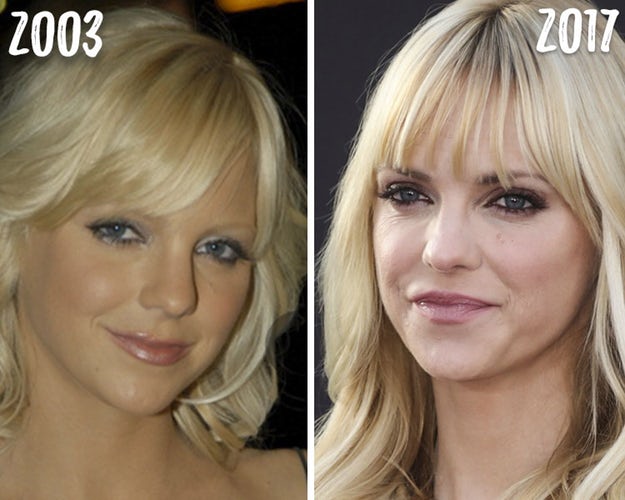 anna-faris-chin-transformation