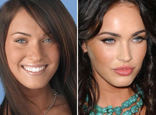 Megan-Fox-Before-And-After-Plastic-Surgery