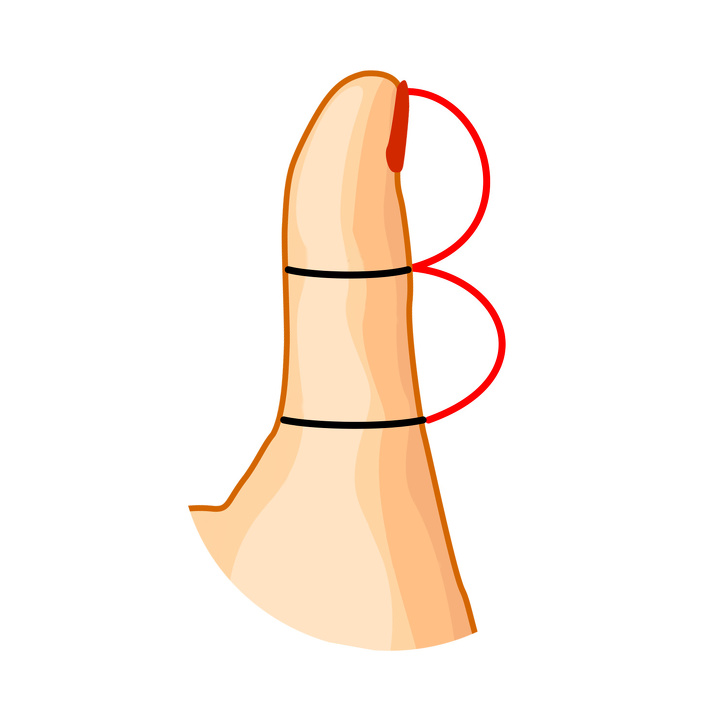 1 1