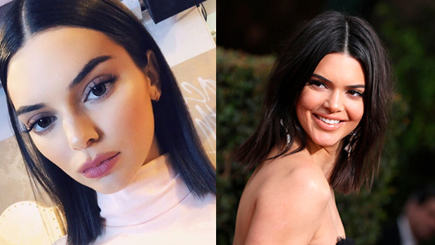 kendall-jenner-looks-completely-different-after-rumored-plastic-surgery-ftr