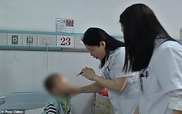 طفل ينجو بأعجوبة بعد اختراق قلم عينة (1)